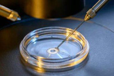 女性不孕不育的原因有哪些？造成女性不孕的原因你占了几个