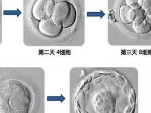 南京三代试管婴儿费用大概要多少钱？附南京三代试管婴儿医院费用表！