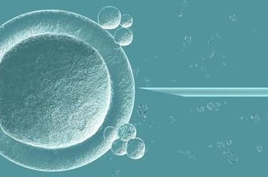 柬埔寨做试管婴儿初次成功的几率有多大 去柬埔寨做试管要准备多少钱